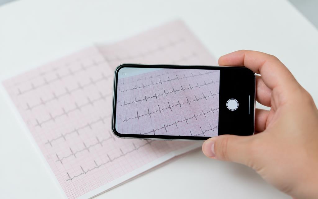 Mão segurando um celular fotografando um ECG em papel
